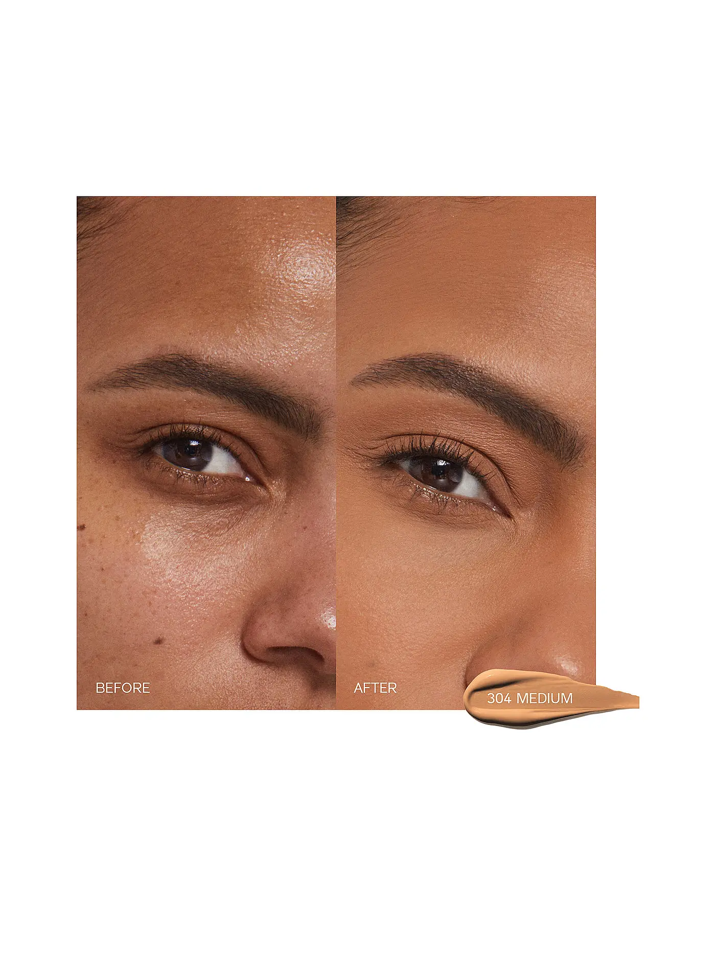 SHISEIDO | Synchro Skin Self-Refreshing Concealer (304 Medium) | 